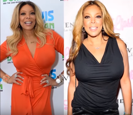 Wendy Williams Boob Job Before and after 1