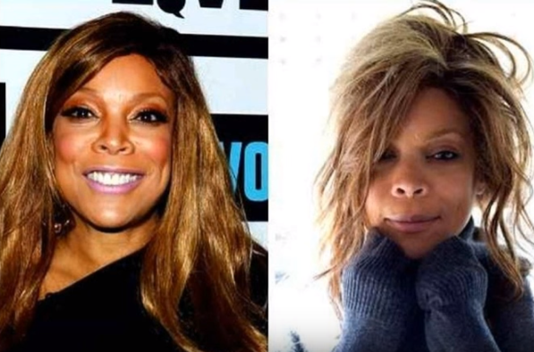 Wendy Williams Plastic Surgery Before and After